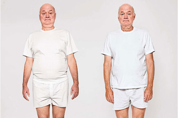before-after-img